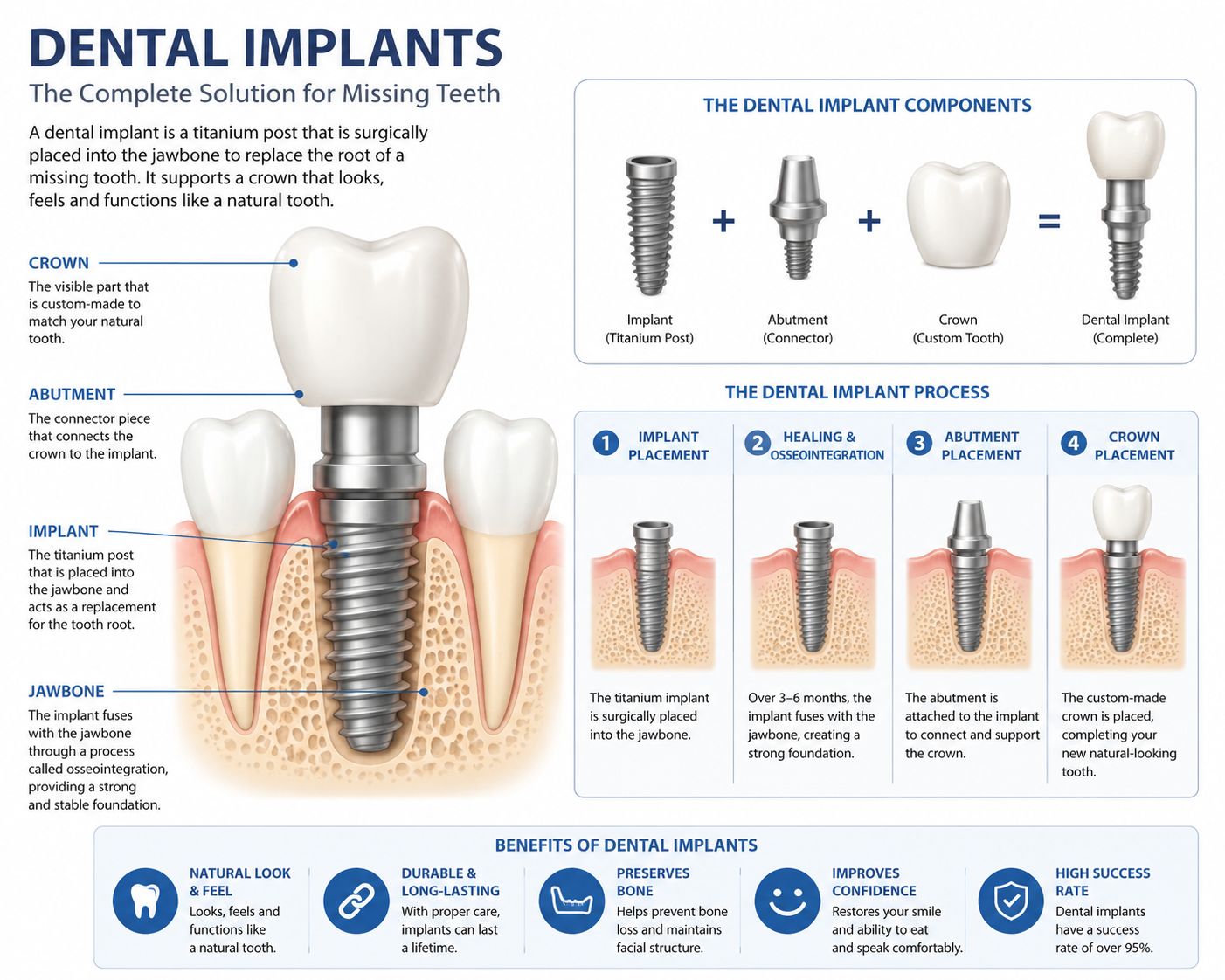 Home 14 The Real Benefits of Dental Implants